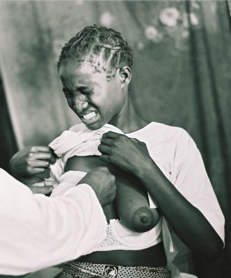 Souffrance maternelle
Souffrance de l'allaitement aprés des jours de douleur...
Mots-clés: medecine congo maternité douleur