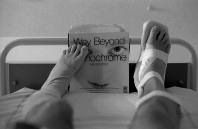 Fracture
